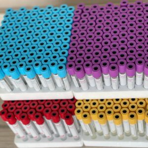 Tubo Vacutainer