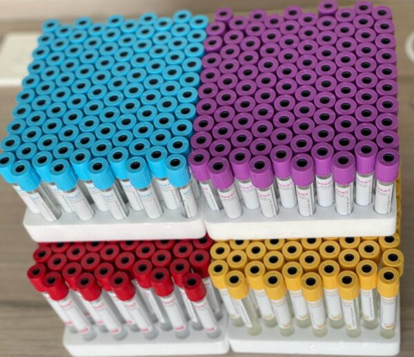 Tubo Vacutainer
